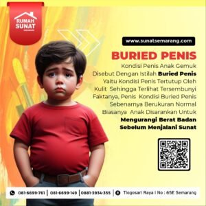 buried penis / penis tenggelam rumah sunat semarang